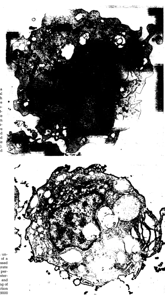 Fig. 4. Electron micrograph of a  macrophage in the peritoneal  exudate of a rainbow trout 20 h  after i.p