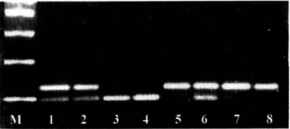 Figure 1. Analysis of the HER2 genotypes - restriction fragment length polymorphism of  the PCR products