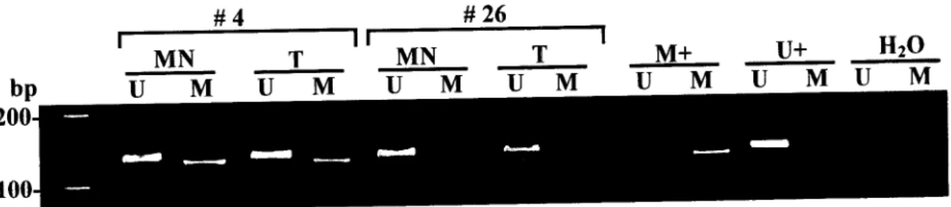 Fig. 1 Illustrative example of MSP for ENDRB promoter region: morphologically normal  (MN) tumor (T) of patients #4 and #26