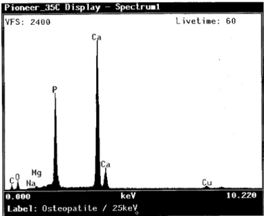 Fig. 18 - Espectro da composição química de um grânulo de Osteopatite®. 