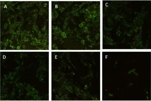 Figure 8 – Human endothelial cells grown for 7 days in the absence (A) and in the presence of  Alendronate at 10 -12  M (B), 10 -10  M (C), 10 -8  M (D), 10 -6  M (E) and 10 -4  M (F)