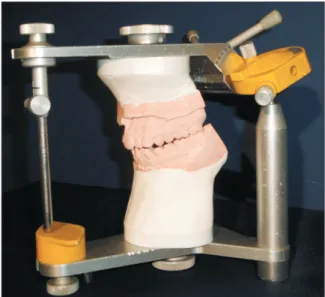 Figure  3.  A  mandibular  position  indicator  registration: 