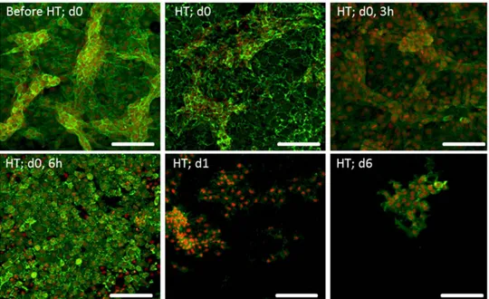 Figure 2. CLSM observation of B16-F10 melanoma cells submitted to a heat treatment (HT), 45 6 C for 30 min, stained for F-actin cytoskeleton (green) and nucleus (red)