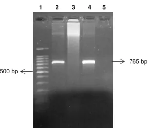 Figura 1. Resolução em gel de agarose dos produtos de PCR com primers EBR específicos para E
