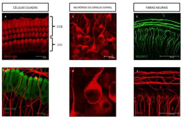 Figura 8 – Cultura de cóclea de camundongos visualizadas à microscopia confocal. 