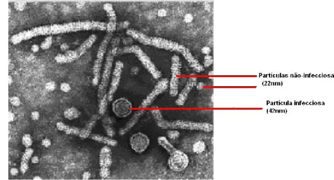Figura 2: Micrografia Eletrônica do HBV. Vírion (partícula infecciosa de 42nm)  indicado por linha vermelha e partículas subvirais filamentosa e esférica não infecciosas  de 22nm