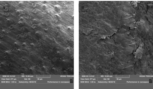 Figura 4: (A)-Micrografia de microscopia de varredura eletrónica, para bagaço de malte antes da biossorção  do corante Preto Reafix Super 2R