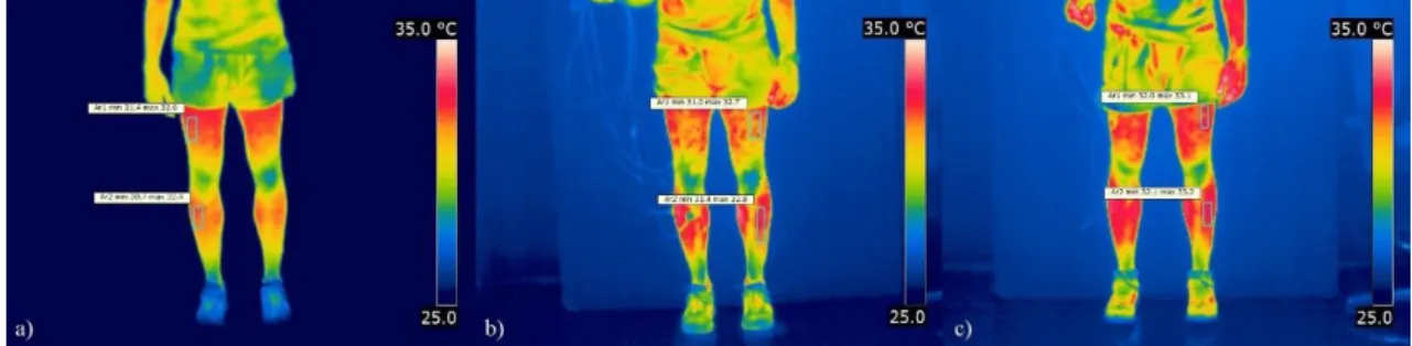 Figura 28 – Análise termográfica da parte anterior das regiões referentes a cada músculo analisado