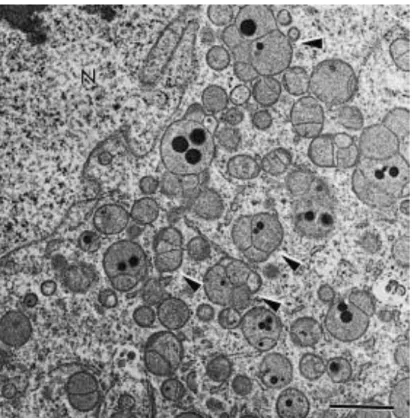 Fig. 2. Dividing mitochondria (arrowheads). Note the presence of electron-dense granules