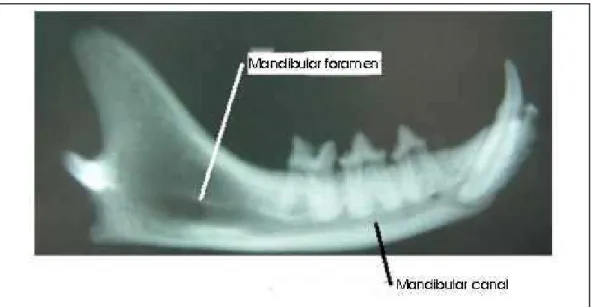 Figure 1 demonstrates the mandibular  foramen and the position of the mandibular canal  through radiographic image