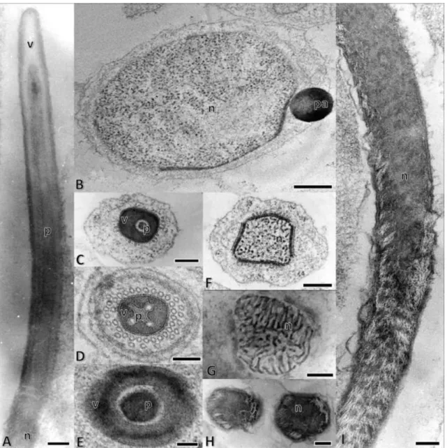 Fig.  2.  Electron  micrographs  of  the  head  region  of  H.  foveolatum  spermatozoa  and  spermatids