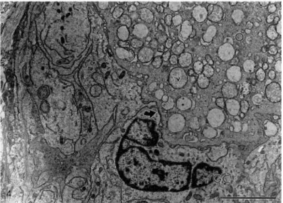 Fig.  4.  Electron  micrograph  of  a  preantral  follicle  preserved  in  coconut  water  solution  at  20°C  for  4  h  apparently normal at the semi-thin section