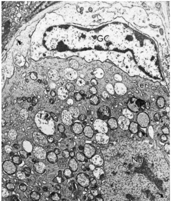 Fig. 5. Electron micrograph of a follicle from control group. GC: granulosa cells, Nu: oocyte  nucleus, m: mitochondria, ser: smooth endoplasmic reticulum, v: vesicles