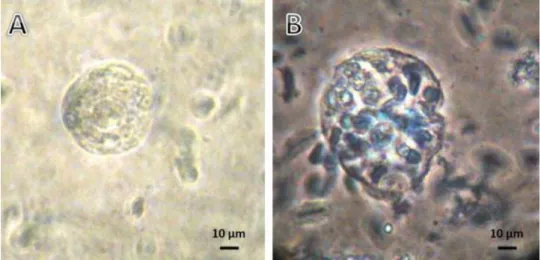 Fig. 2.  Photomicrographs of trypan blue dye-treated preantral follicles that were mechanically isolated  from vitrified ovarian tissue showing (A) viable follicle (not stained) and a (B) nonviable follicle (stained)