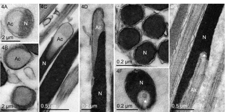 Fig. 4. TEM of head region of spermatozoa of L. cuprina (A), L. eximia (B,C,E), and L