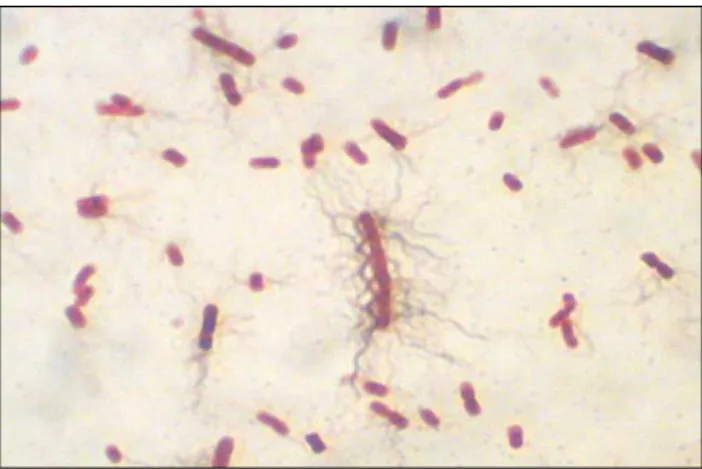 Figura  4.  P.  vulgaris  bactéria  Gram  negativa  demonstrada  por  coloração  vermelha/rosa