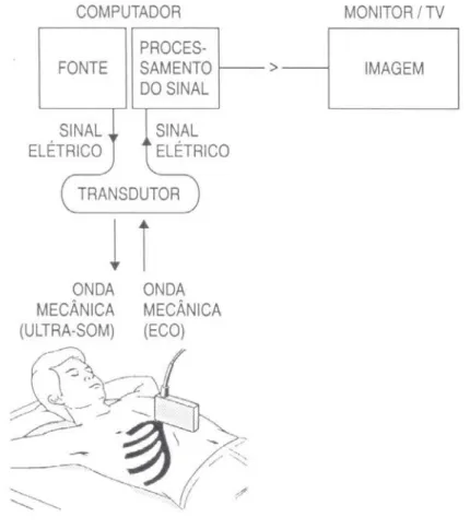 Figura 8 (Reproduzida de KOCH et al., 1997). Esquema do funcionamento de um equipamento de ultra- ultra-sonografia