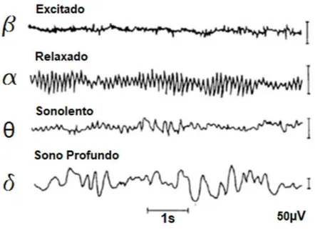 Figura 2.4 - Formas de ondas do sinal EEG. Modificado de [46]. 