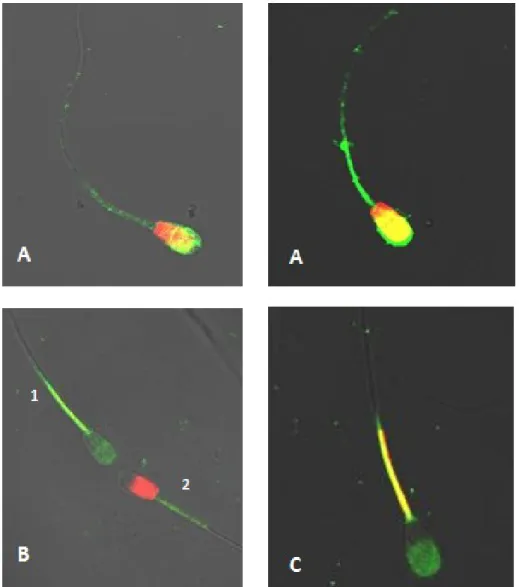 Figura 4. Fotomicrografia de epifluorescência das células espermáticas coradas com a associação  das  sondas  fluorescentes  IP,  FTIC-PSA  e  JC-1  (aumento  40x)