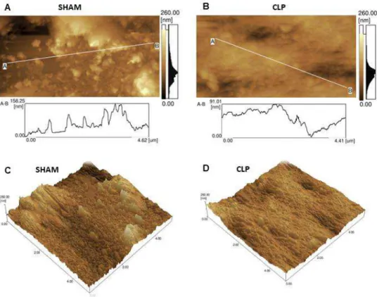 Figure  10.  Bone  surface  roughness  by  Atomic  force  microscopy  (AFM).  AFM  Imaging in Cortical Bone