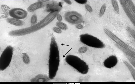 Figura 9. Foto de  eletromicrografia eletrônica  de  espermatozoide  com grau fraco de  descompactaçã o  de cromatina  (seta).