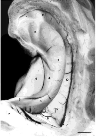 Figura  4 –   (Figura  adaptada  de  Durvenoy,  2005)  [3]  Parte  intraventricular  do  hipocampo