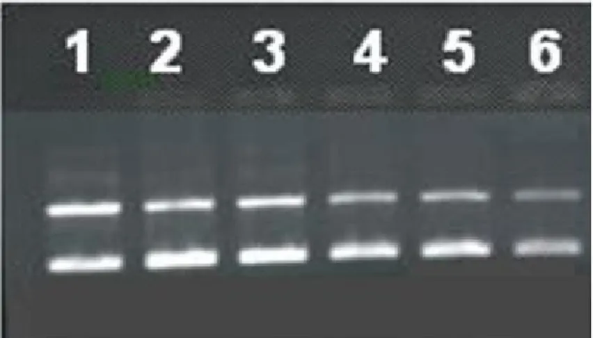 Figura 10: Foto do gel de agarose mostrando o efeito da variação da concentração de AE na  degradação oxidativa do DNA plasmidial em meio contendo 5 mM de Kpi, 15 µM de Cu(II) e 1  mM de ascorbato