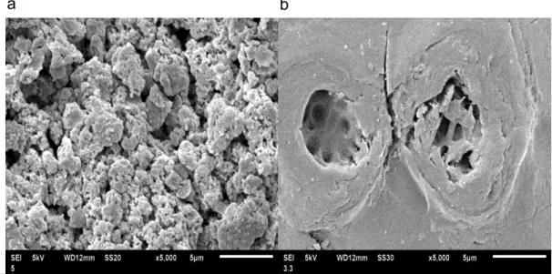 Figura 10: Microscopia eletrônica de varredura para o HDL, com a expansão de  5000.  (a)  o  material  antes  do  processo  de  adsorção;  (B)  material  depois  do  processo de adsorção de cromo