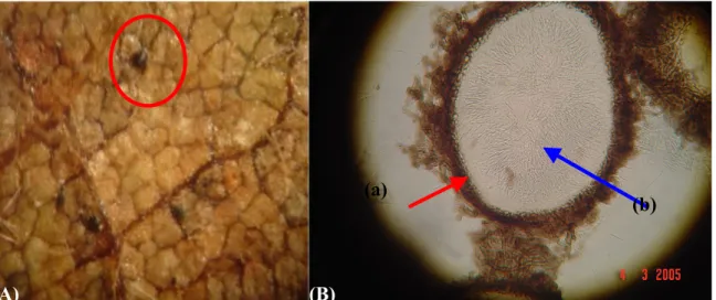 Figura 5. (A) Detalhe de picnídio com cirrus de Septoria glycines. (B) picnídio e conídios (a)  picnídio e (b) conídios