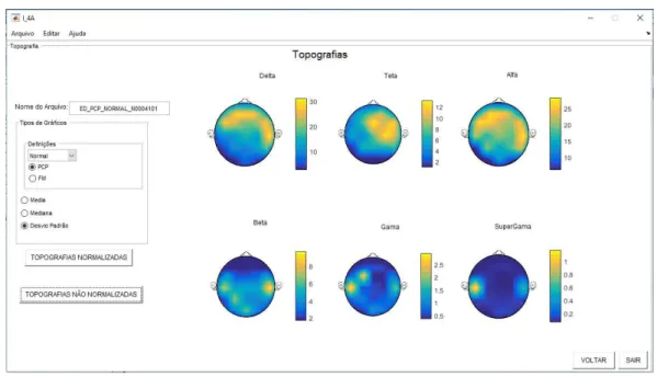 Figura 6: Interface de Visualização de Topografias. 