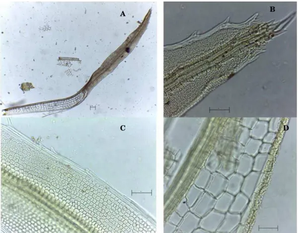 Figura  11  a-d)  Syrrhopondon  gaudichaudii.  a)  Filídio  (50  µm).  b)  Àpice,  margem  com  limbídio e dentes (20 µm)