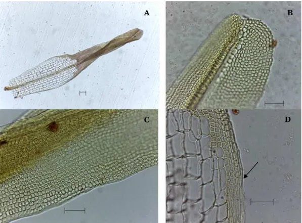 Figura 13 a-d). Syrrhopodon ligulatus. a) Filídio (50 µm). b) Ápice do filídio (20 µm)
