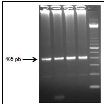 Figura 6: Eletroforese em gel de agarose 2% mostrando um amplicon específico para a região  DMR  do  exon  1  do  gene  XIST  de  ovócitos  MII  de  bovinos  utilizando  como  molde  DNA  genômico tratado com bissulfito de sódio