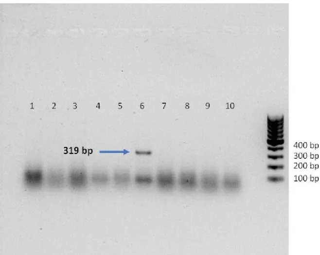 Figura 3. Eletroforese em gel de agarose de produtos de RT-PCR utilizando primers específicos  para a proteína do nucleocapsídeo do vírus da cinomose (319pb)