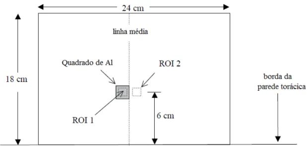 Figura 4.3: Ilustração das ROIs para medir o CNR 