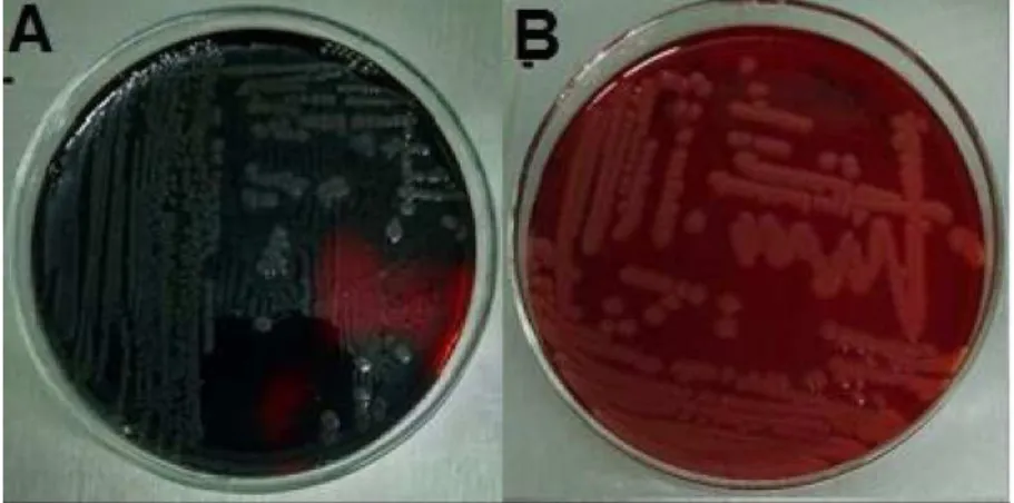 Tabela 2  -  Distribuição  de  isolados  bacterianos  de  urina  de  cães  com  cistite  e  avaliação  da  formação  de  biofilme  em  Ágar  Vermelho  Congo  e  Teste  de  microplacas  com  corante  cristal  violeta 