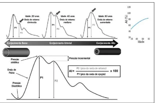 Figura  2 - Reflexão  da  Onda  de  Pulso 