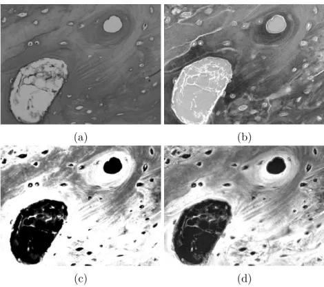 Figura 25 – Imagens resultantes do pré-processamento. As imagens (a) e (b) são usadas posteriormente na fase de segmentação