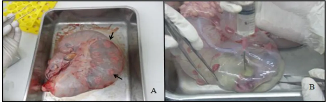 Figura  2.  A)  Dissecação  das  camadas  uterinas.  Observar  os  placentomas  (setas);  B)  Aspiração do fluido amniótico para isolamento das células amnióticas