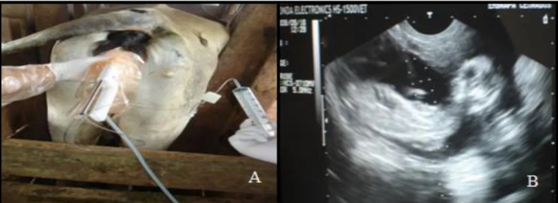 Figura 4: A) Sistema utilizado para aspiração  in vivo de líquido amniótico; B) Imagem  ultrassonográfica  demonstrando  o  correto  posicionamento  do  feto  no  momento  da  coleta do líquido amniótico, as três linhas tracejadas apontam a orientação da s