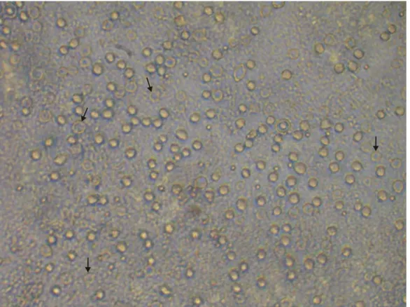 Figura 6. Cistos e trofozoítos de Acanthamoeba  na superfície do ágar-soja em  placa de Petri