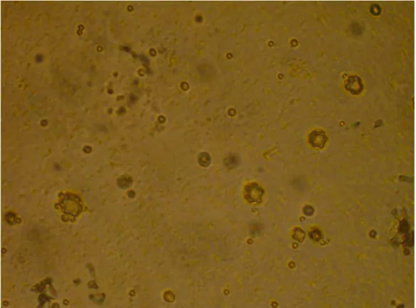 Figura 7. Cistos de Acanthamoeba na superfície do ágar-soja em placa de Petri. 