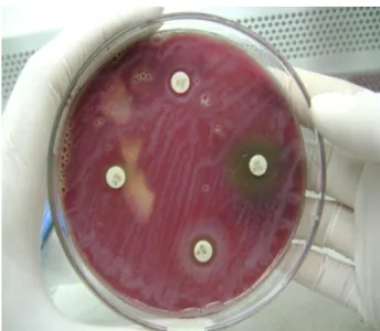 Figura  2  Antibiograma  em  ágar  Müller-Hinton  suplementado  com  5%  de  sangue  de  ovino  para  a  identificação  de  halo  de  inibição  de  C