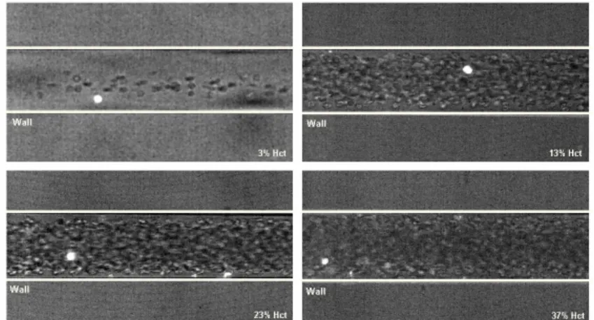 Figure 3 shows images with both non-labeled RBCs (halogen illumina- illumina-tion) and labeled RBCs (laser-emitted light) measured in centre plane of 75  µm  circular  PDMS  microchannel  at  several  Hcts  (from  3%  to  37%)  with  Re from 0.004 to 0.005