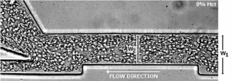 Figure 4. Flow visualization of in vitro blood in a micrchannel with the following  dimensions:  W 1  = 100 m and W 2   = 75m
