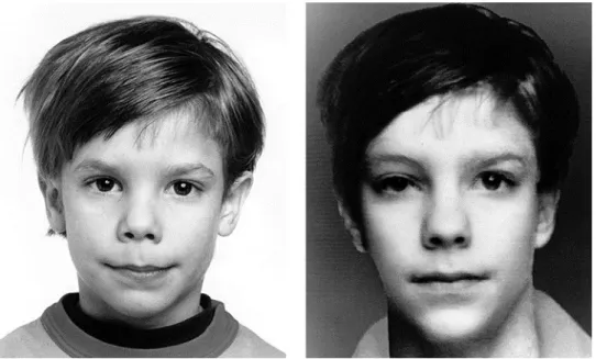 Figura 18: Nancy Burson. Amadurecimento de Etan Patz (aos 6 e 13 anos),  1984. 