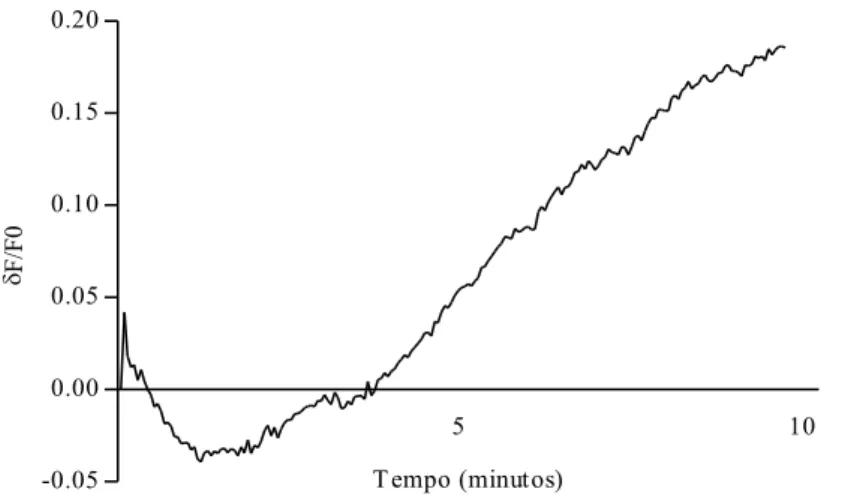 Figura  7:  Efeito  do  diazóxido  (10  µM)  sobre  o  potencial  de  repouso  de  um  neurônio  nociceptivo  periférico