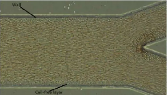 Figure 3: The original image of blood sample flowing in a bifurcating microchannel.