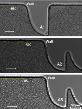 Figure 4 shows the tracking of a representative individual RBC flowing around the boundary of the  RBCs  core  at  hyperbolic  microchannel  with  a  H  =  2  and  with  one  (A1)  ten  (A2)  and  twenty  (A3)  series of hyperbolic contractions