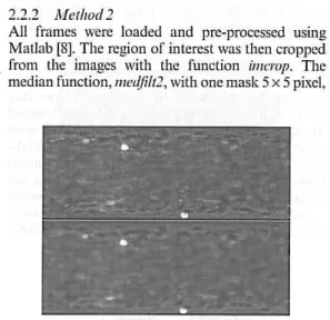 Figure 2.  The  regian  af intercst  (above) and  lhe  image  liltercd  by  using the median functian mcdjU/2